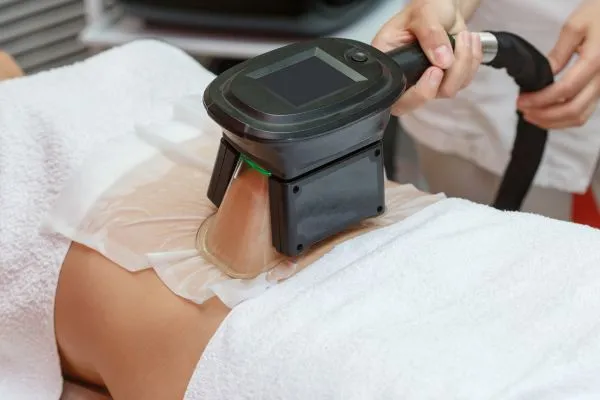 Image of person having fat freezing treatment to help weight gain Poole