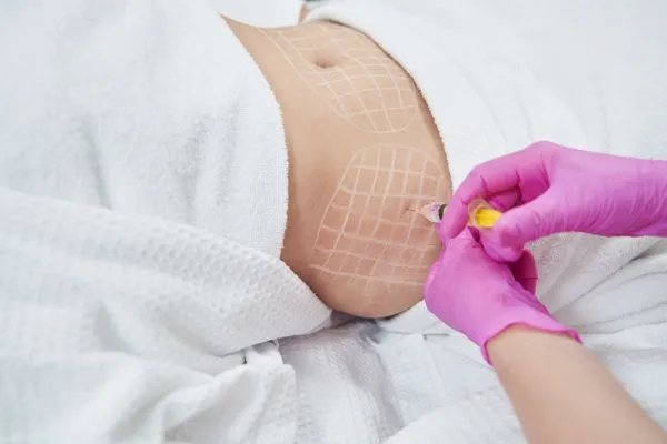 image of fat dissolving injections on love handles to help combat weight gain Poole